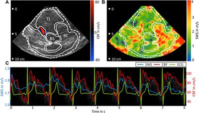 Stiffness pulsation of the human brain detected by non-invasive time-harmonic elastography